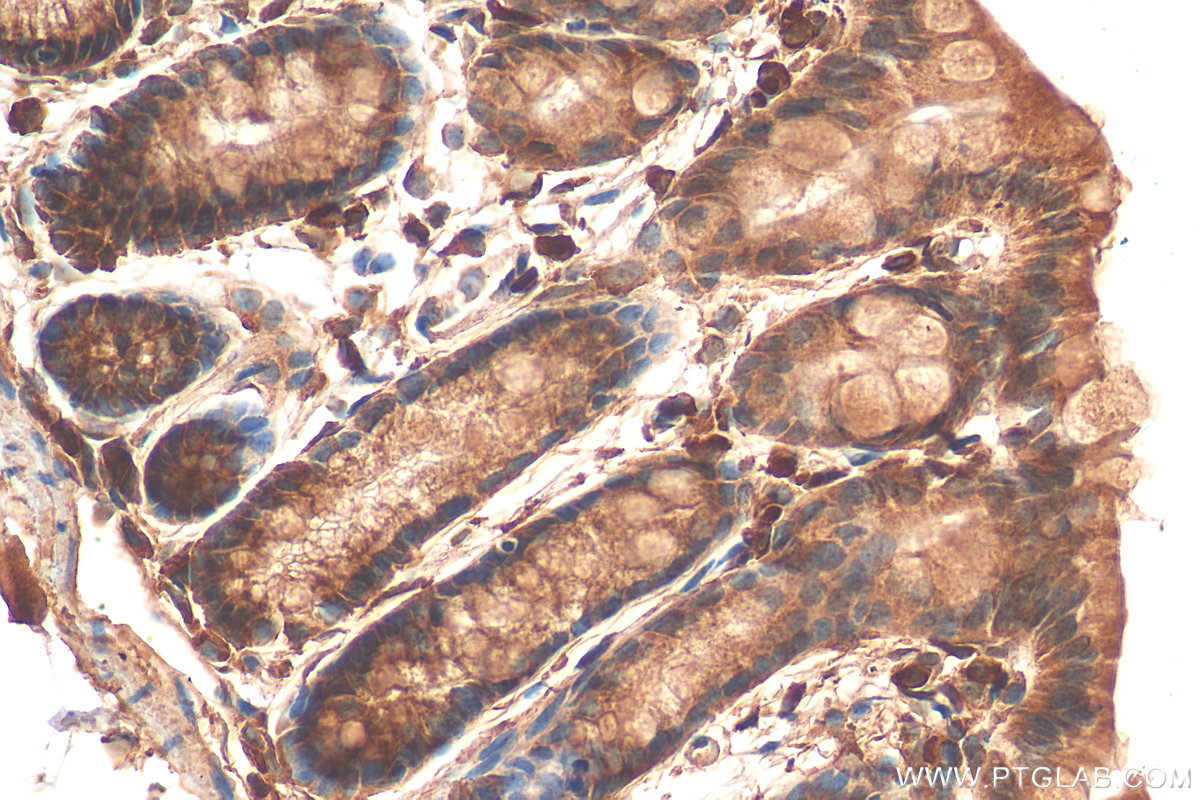 Immunohistochemistry (IHC) staining of mouse colon tissue using A1CF Polyclonal antibody (25812-1-AP)