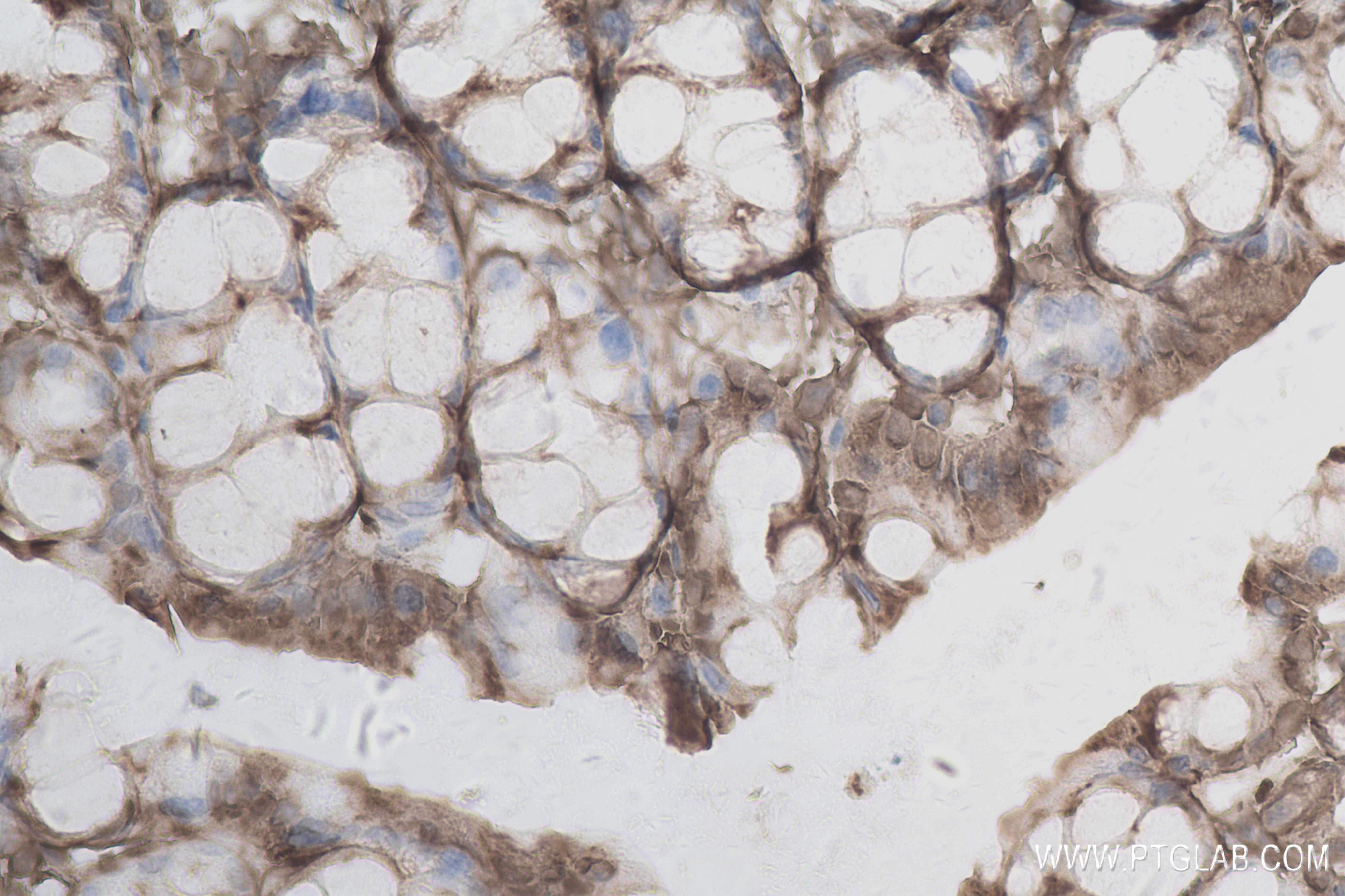 Immunohistochemistry (IHC) staining of mouse colon tissue using A1CF Recombinant antibody (84322-4-RR)