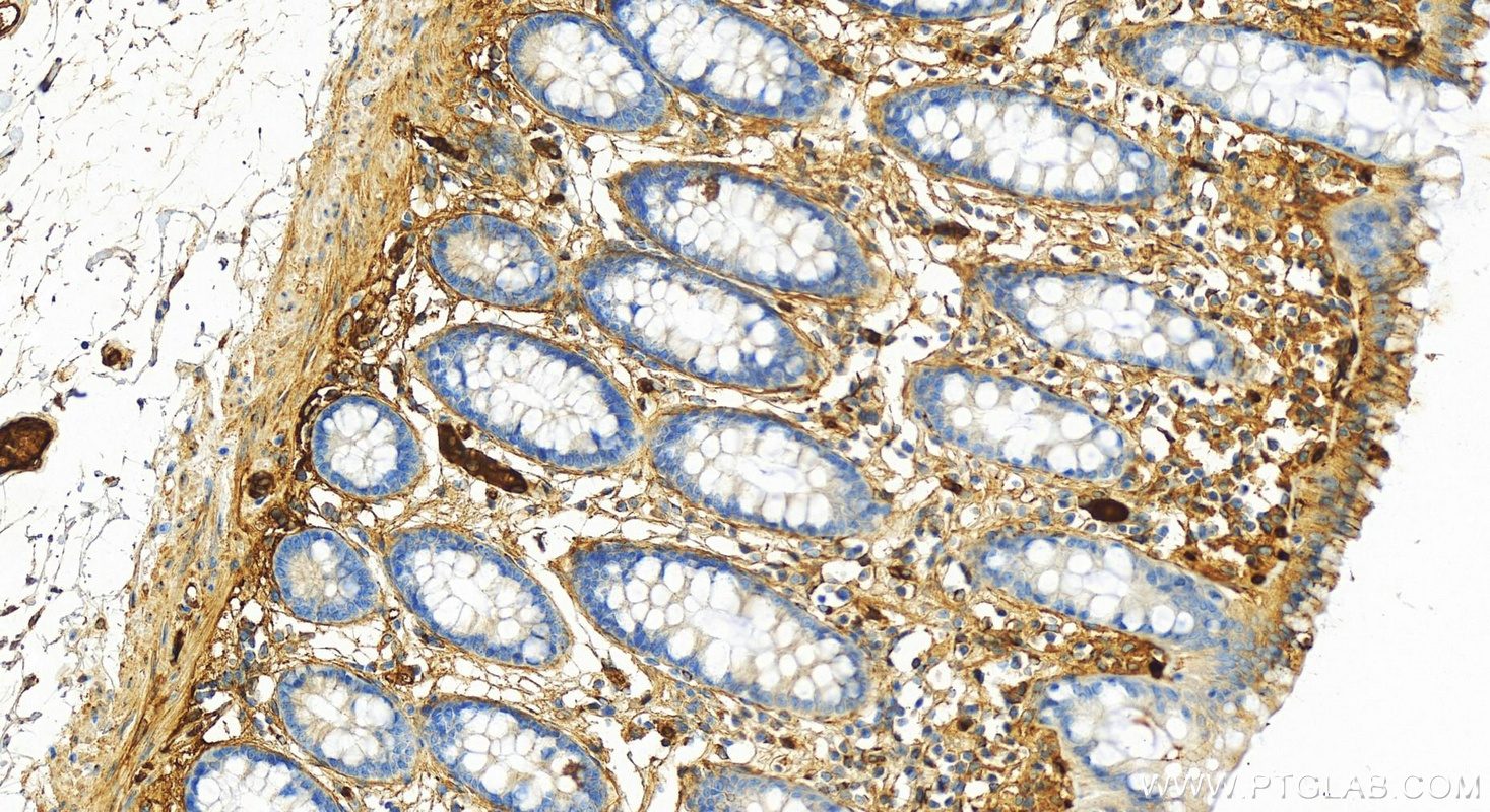 Immunohistochemistry (IHC) staining of human colon tissue using Alpha-2-Macroglobulin Polyclonal antibody (13545-1-AP)