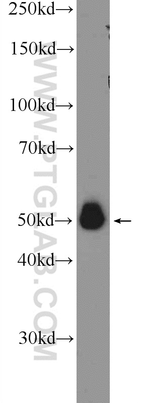 Western Blot (WB) analysis of RAW 264.7 cells using A4GALT Polyclonal antibody (12392-1-AP)