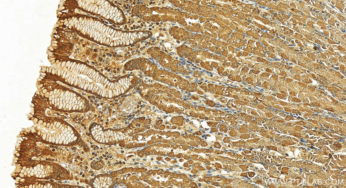 Immunohistochemistry (IHC) staining of human stomach tissue using A4GNT Polyclonal antibody (22670-1-AP)