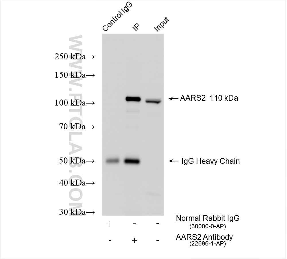 Immunoprecipitation (IP) experiment of K-562 cells using AARS2 Polyclonal antibody (22696-1-AP)