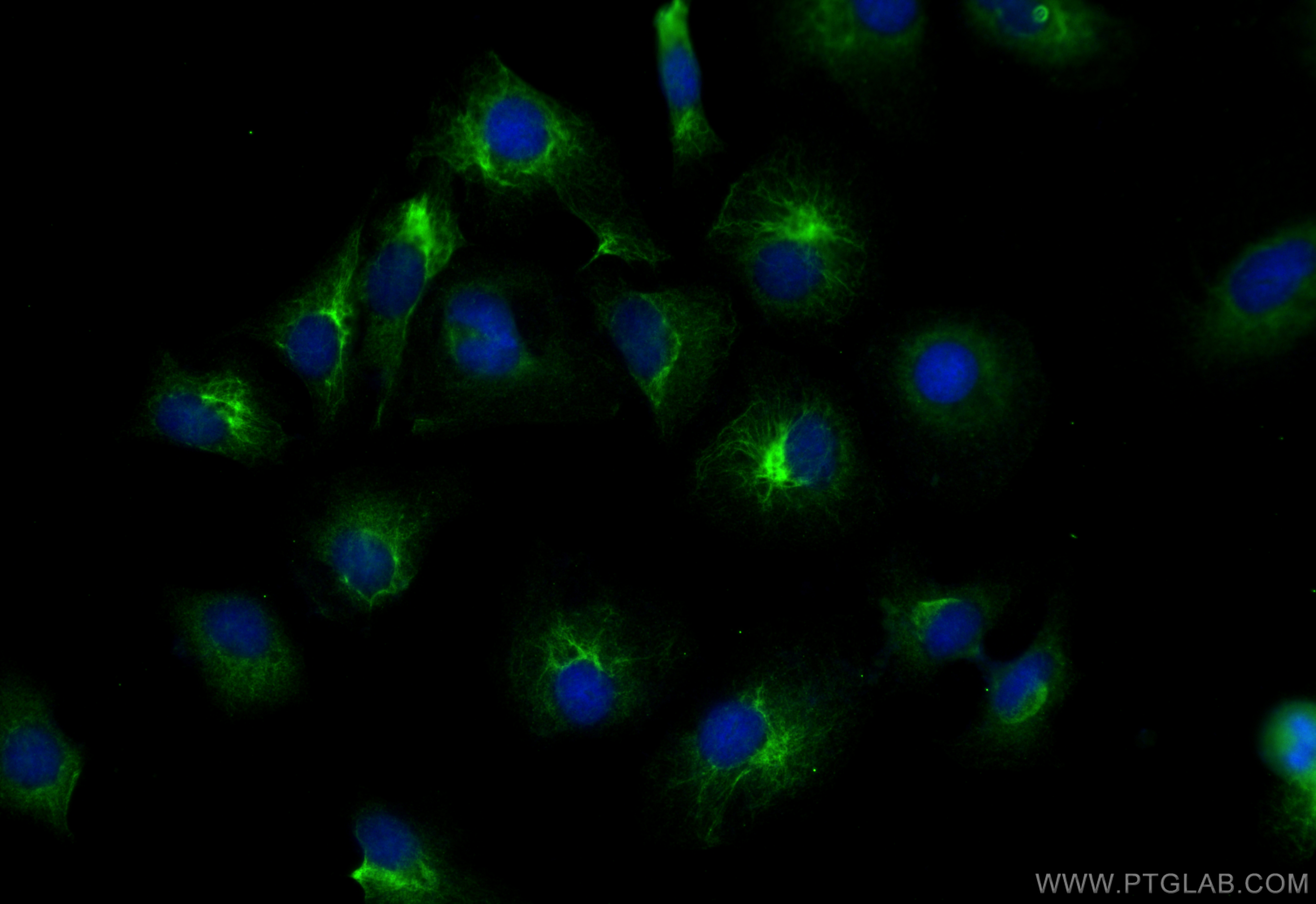 Immunofluorescence (IF) / fluorescent staining of HeLa cells using AASDHPPT Polyclonal antibody (11244-1-AP)