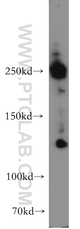 Western Blot (WB) analysis of HepG2 cells using ABCA2 Polyclonal antibody (20681-1-AP)
