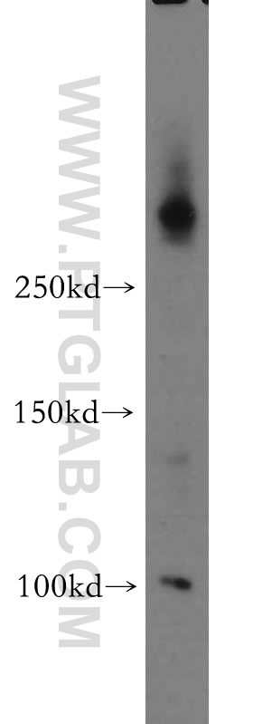 Western Blot (WB) analysis of mouse thymus tissue using ABCA2 Polyclonal antibody (20681-1-AP)