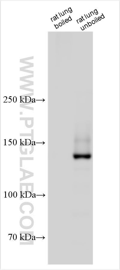 Western Blot (WB) analysis of various lysates using ABCA3 Polyclonal antibody (27450-1-AP)