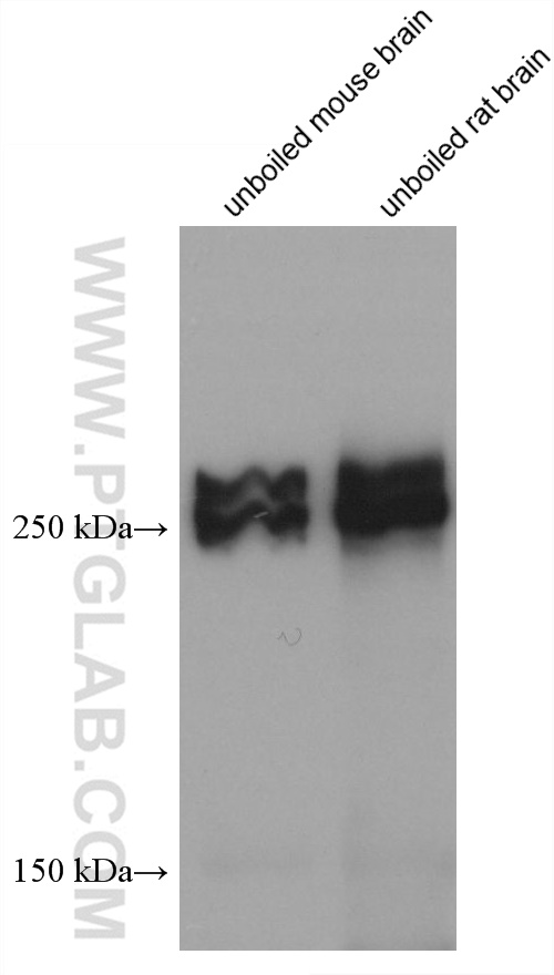 Western Blot (WB) analysis of various lysates using ABCA7 Monoclonal antibody (67128-1-Ig)