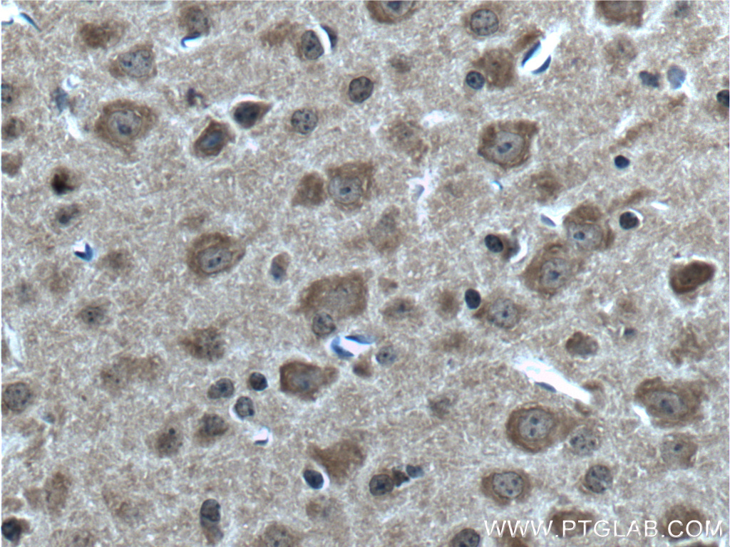 Immunohistochemistry (IHC) staining of mouse brain tissue using ABCA8 Polyclonal antibody (24351-1-AP)