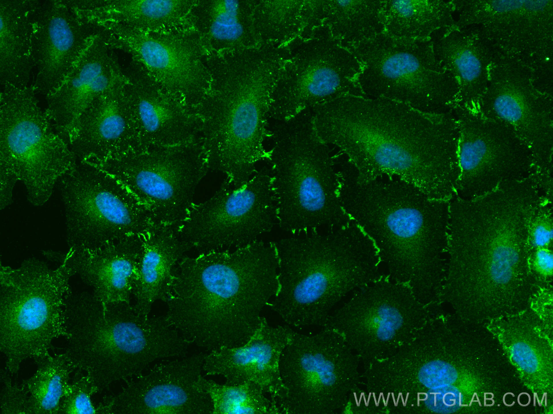 Immunofluorescence (IF) / fluorescent staining of A549 cells using MRP1 Monoclonal antibody (67228-1-Ig)