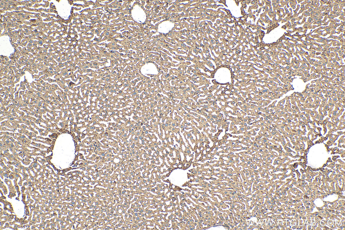 Immunohistochemistry (IHC) staining of mouse liver tissue using ABCC10 Polyclonal antibody (30697-1-AP)