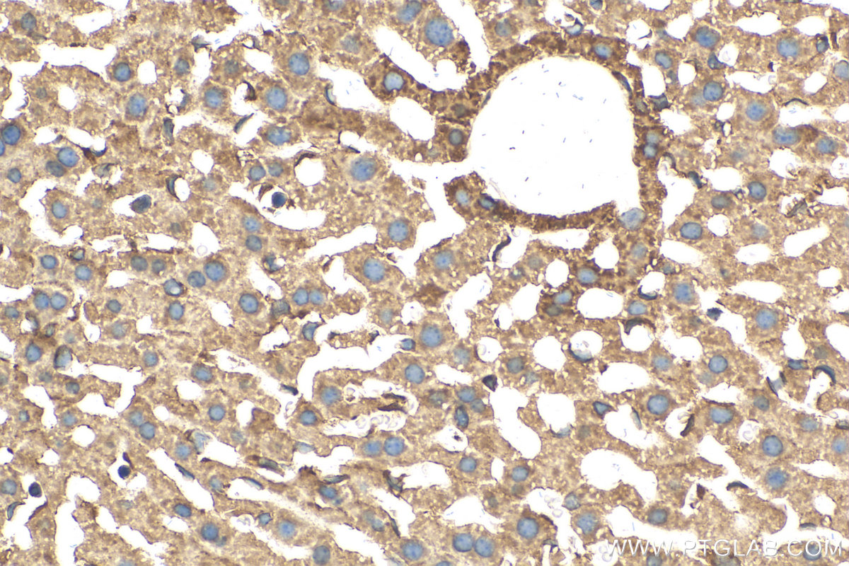 Immunohistochemistry (IHC) staining of mouse liver tissue using ABCC10 Polyclonal antibody (30697-1-AP)