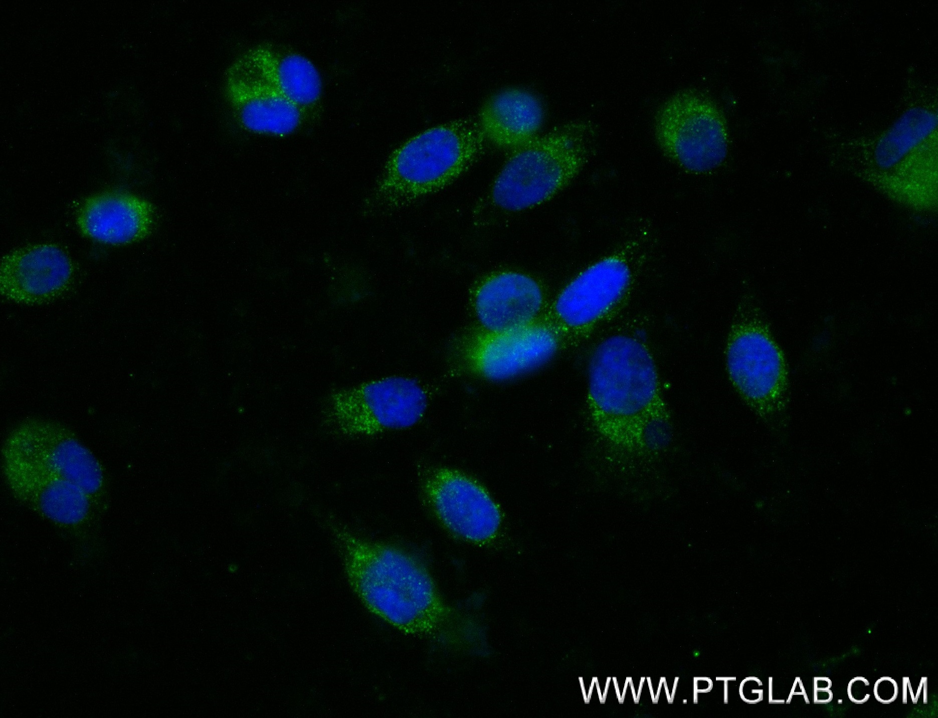 Immunofluorescence (IF) / fluorescent staining of PC-3 cells using ABCC5 Recombinant antibody (84204-5-RR)