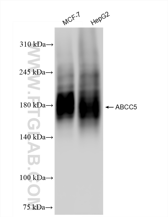 Western Blot (WB) analysis of various lysates using ABCC5 Recombinant antibody (84204-5-RR)