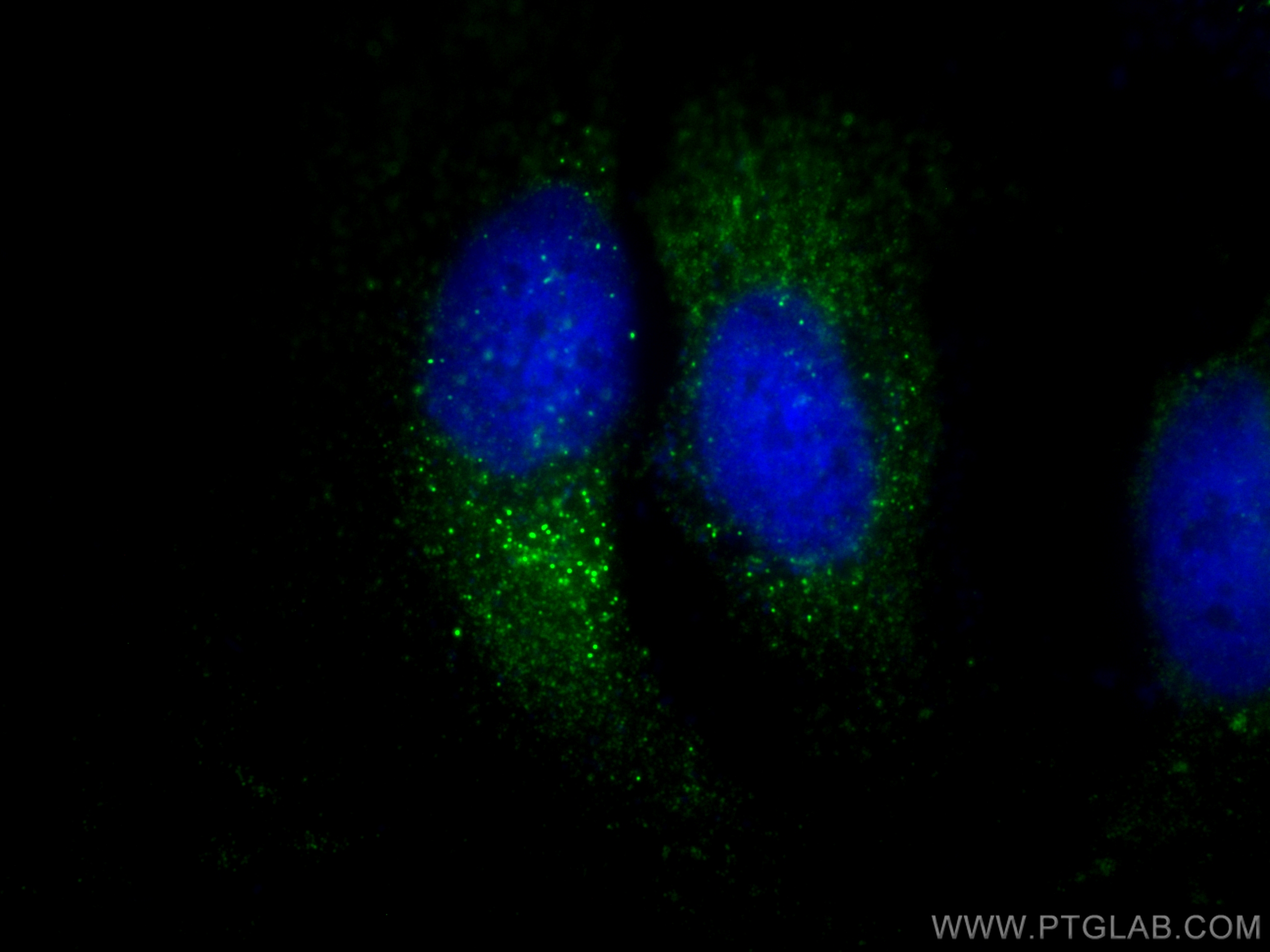 Immunofluorescence (IF) / fluorescent staining of HeLa cells using ABCD1 Polyclonal antibody (18138-1-AP)