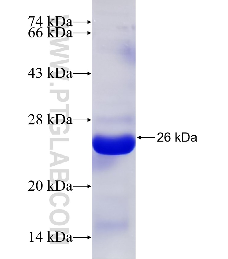 ABCD1 fusion protein Ag32671 SDS-PAGE