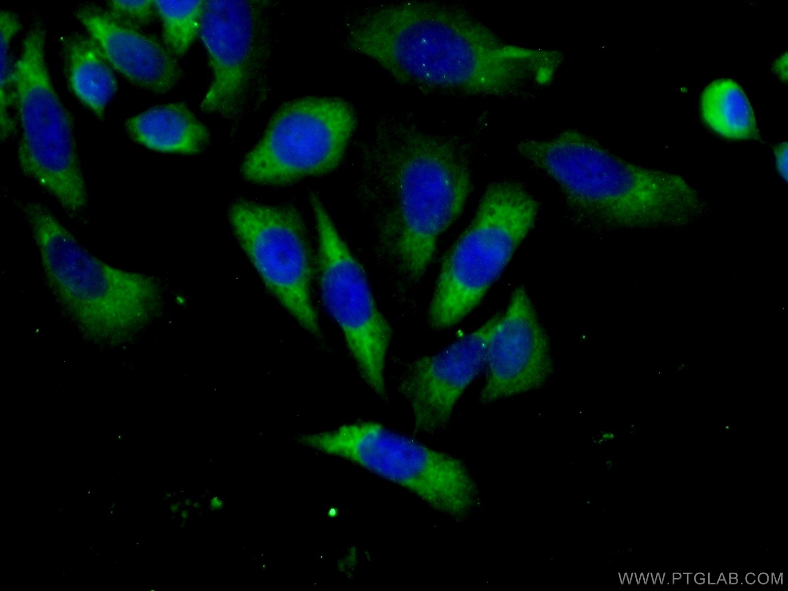 Immunofluorescence (IF) / fluorescent staining of HeLa cells using ABCF1 Polyclonal antibody (13950-1-AP)
