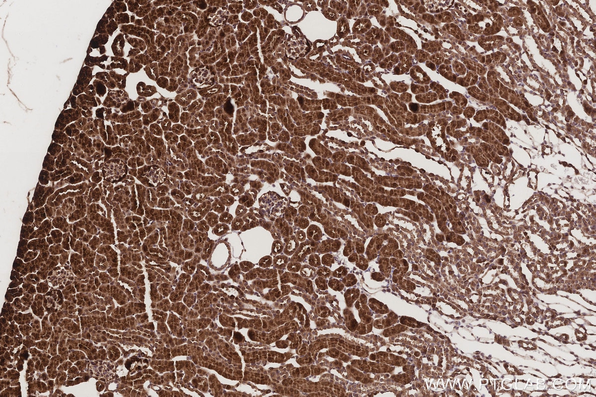 Immunohistochemistry (IHC) staining of mouse kidney tissue using ABCG1 Polyclonal antibody (13578-1-AP)