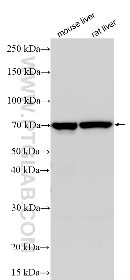 Western Blot (WB) analysis of various lysates using ABCG5 Polyclonal antibody (27722-1-AP)