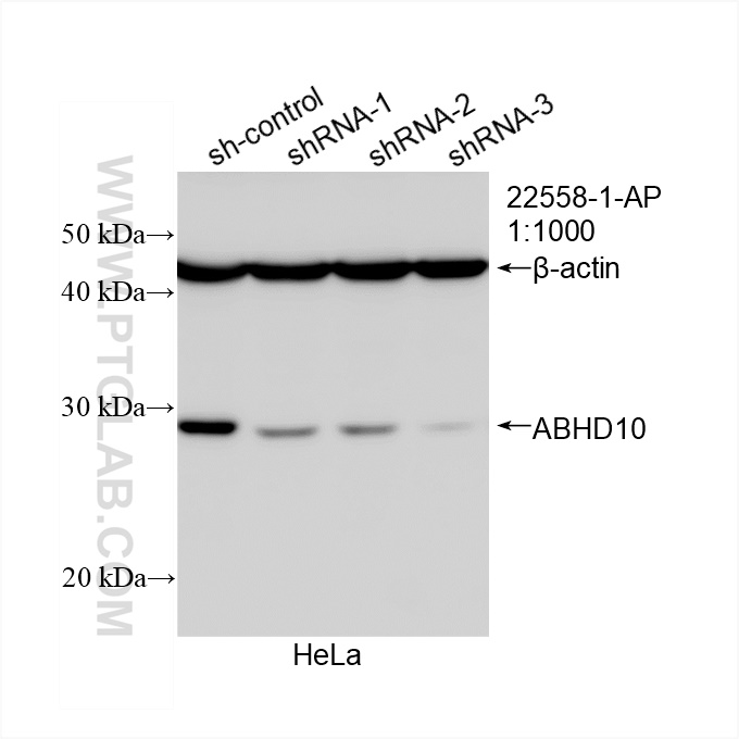 Western Blot (WB) analysis of HeLa cells using ABHD10 Polyclonal antibody (22558-1-AP)