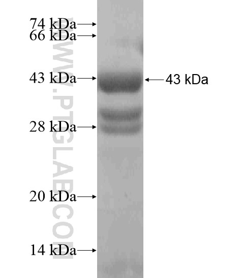 ABHD11 fusion protein Ag19403 SDS-PAGE