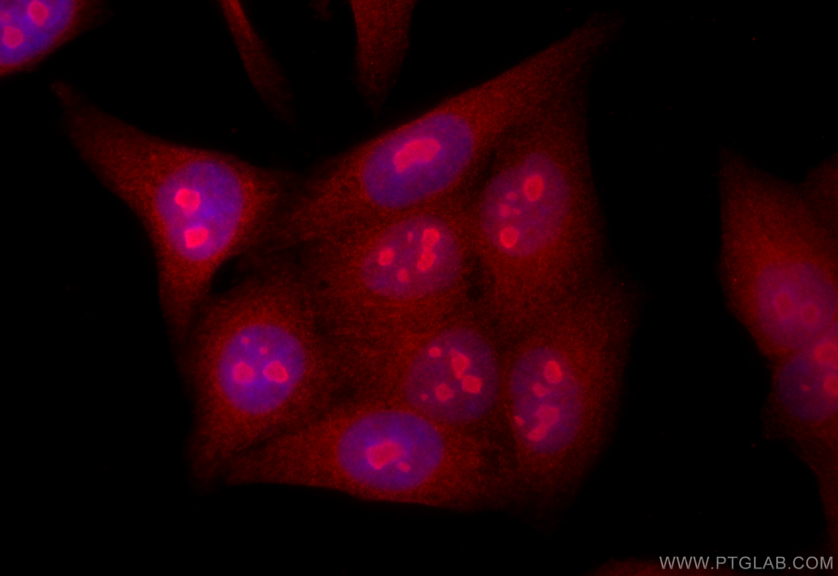 Immunofluorescence (IF) / fluorescent staining of HepG2 cells using ABHD14B Polyclonal antibody (20952-1-AP)