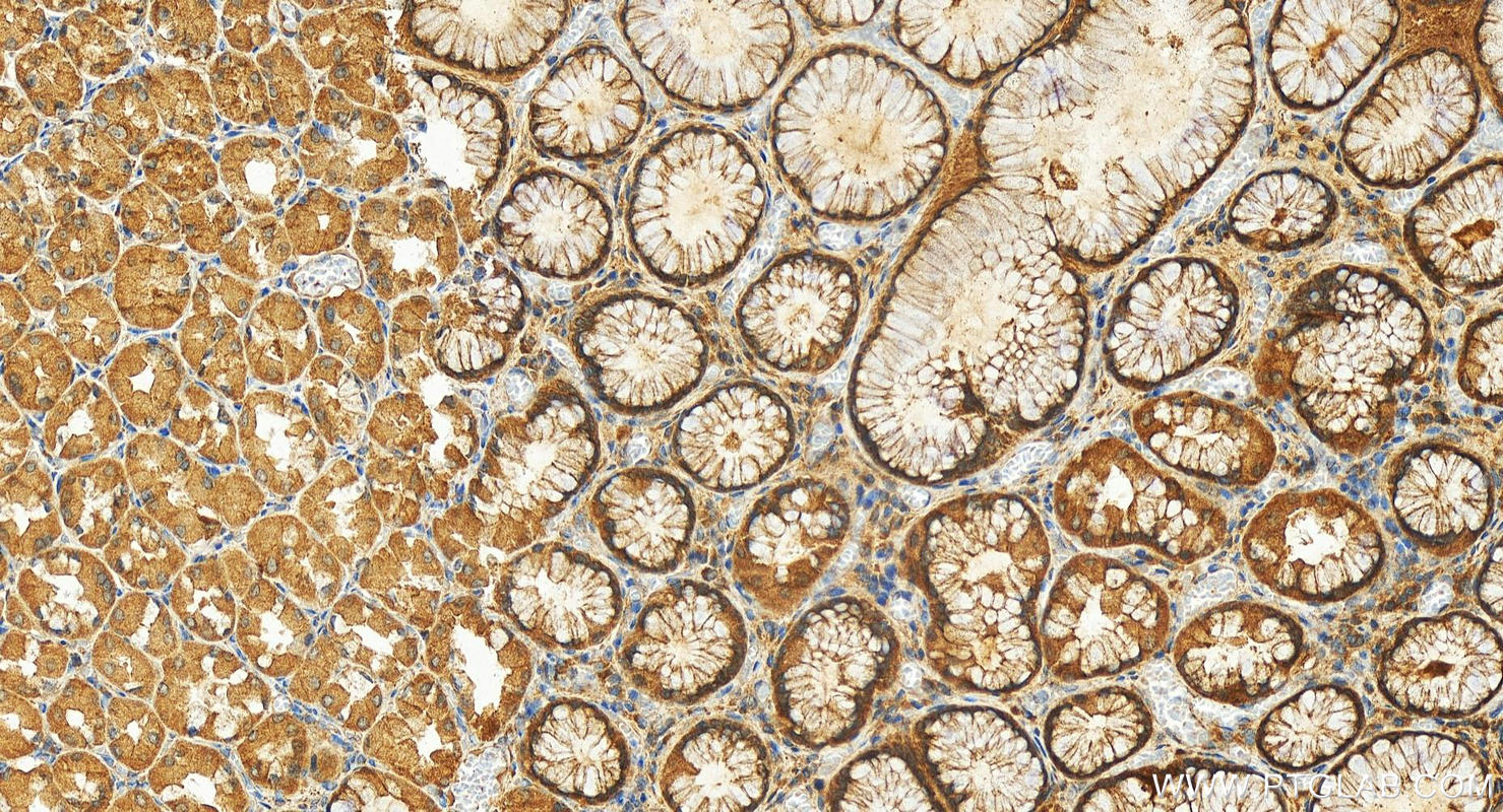 Immunohistochemistry (IHC) staining of human stomach tissue using ABHD2 Polyclonal antibody (14039-1-AP)