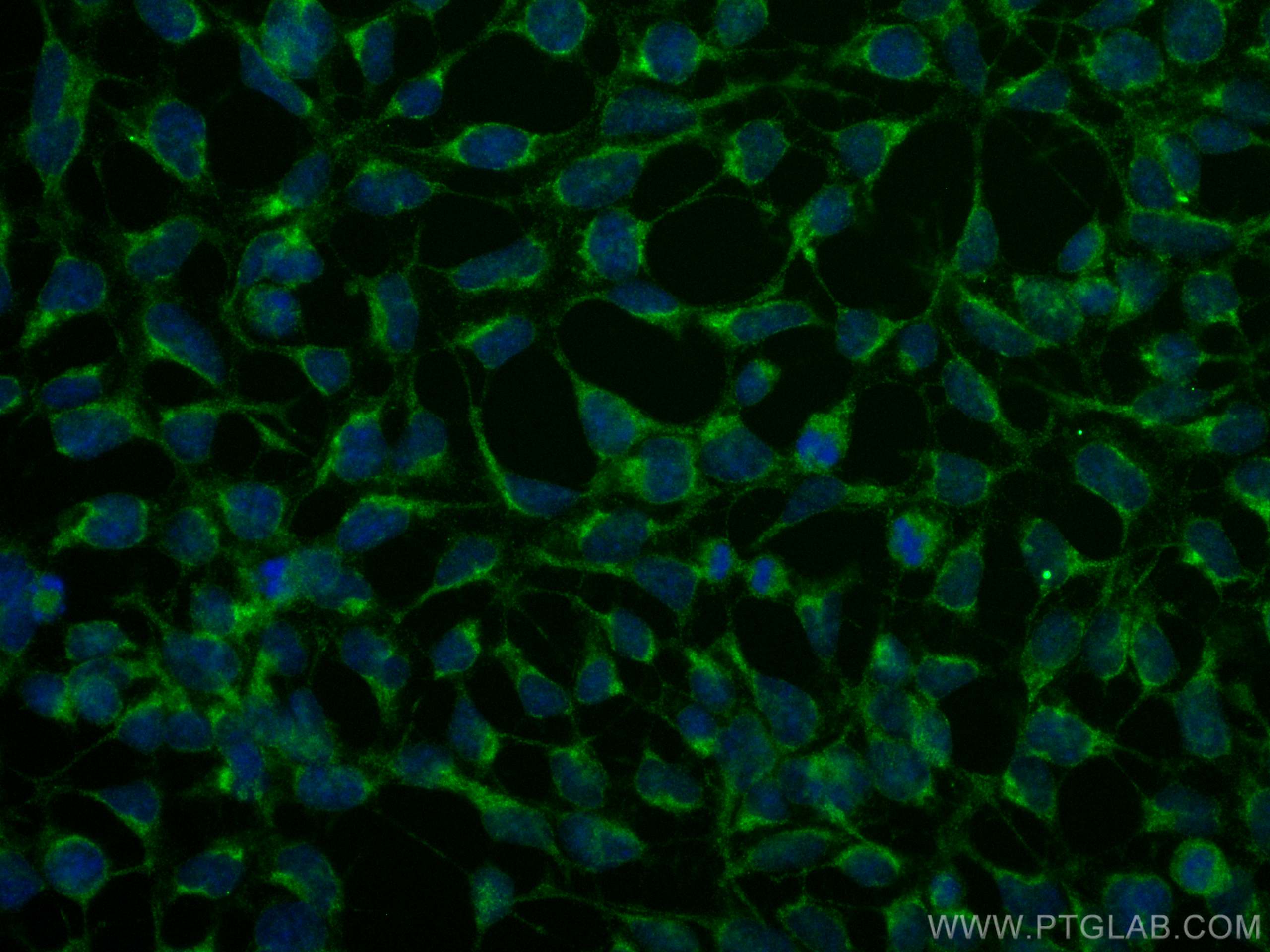 Immunofluorescence (IF) / fluorescent staining of HEK-293 cells using ABHD2 Polyclonal antibody (14039-1-AP)