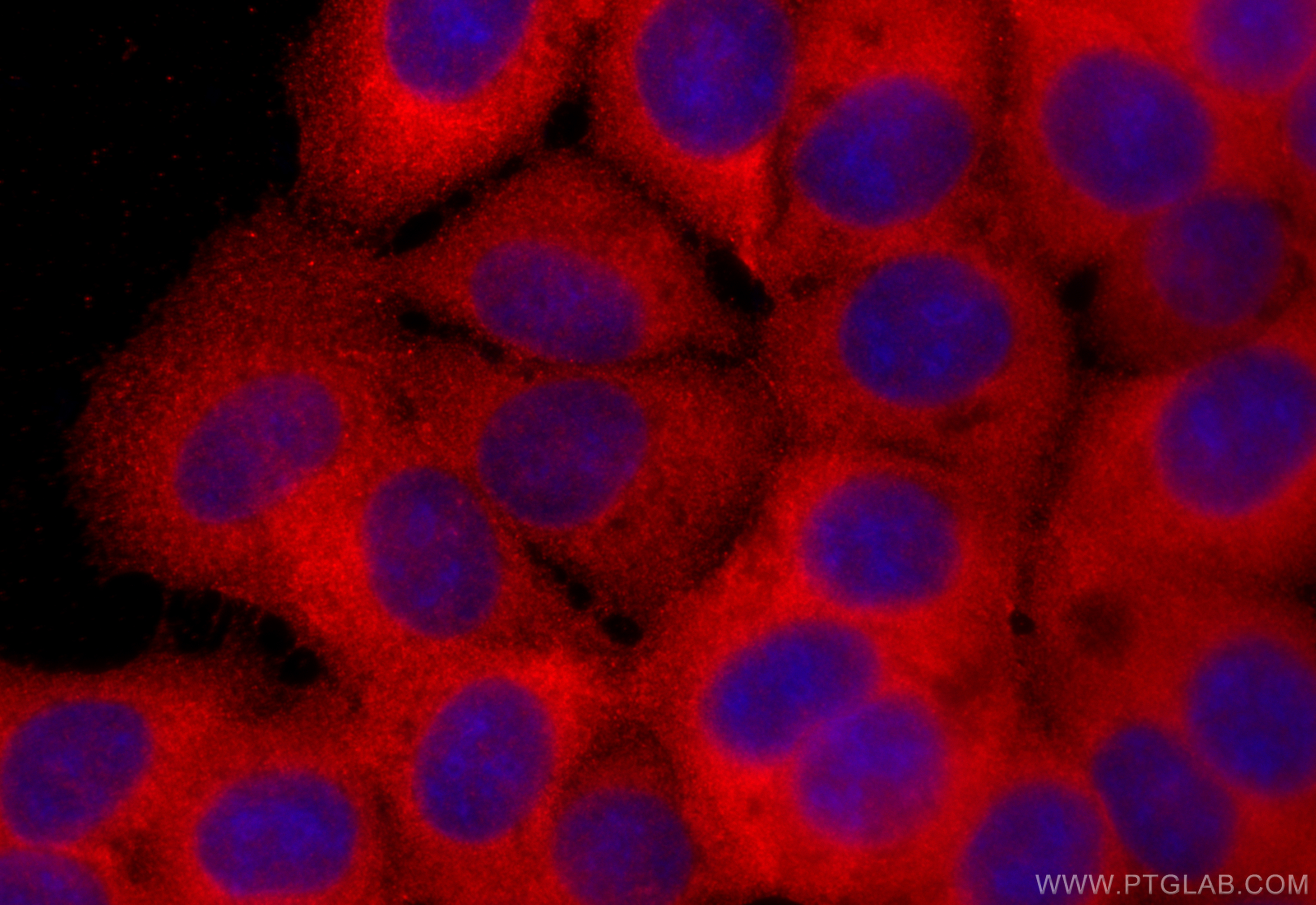 Immunofluorescence (IF) / fluorescent staining of MCF-7 cells using ABHD5 Polyclonal antibody (12201-1-AP)