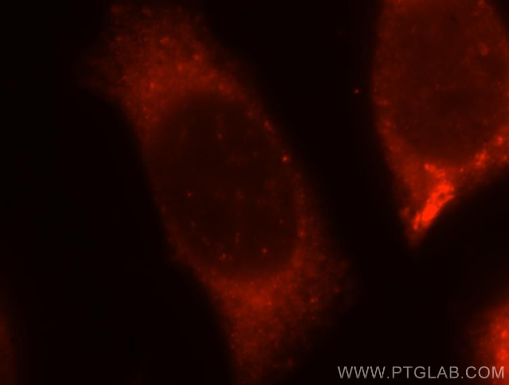 Immunofluorescence (IF) / fluorescent staining of MCF-7 cells using ABHD5 Polyclonal antibody (12201-1-AP)