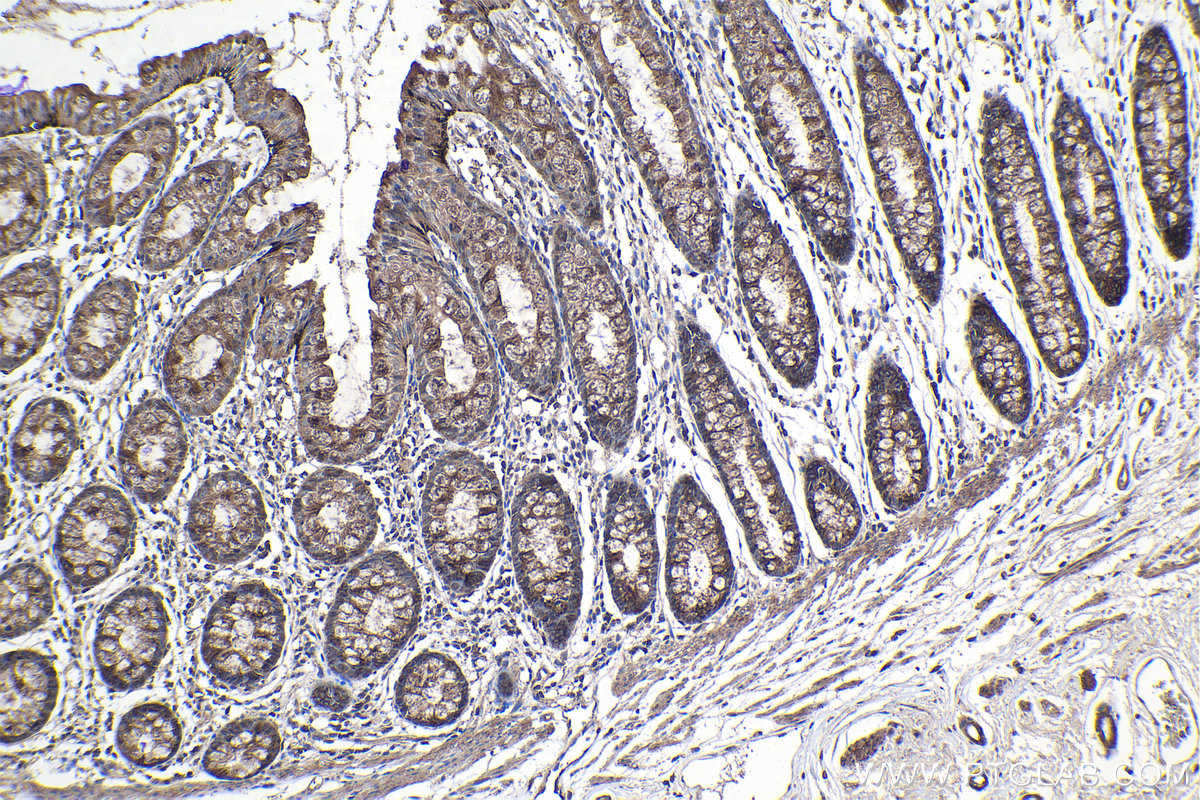 Immunohistochemistry (IHC) staining of human colon tissue using ABHD5 Polyclonal antibody (12201-1-AP)