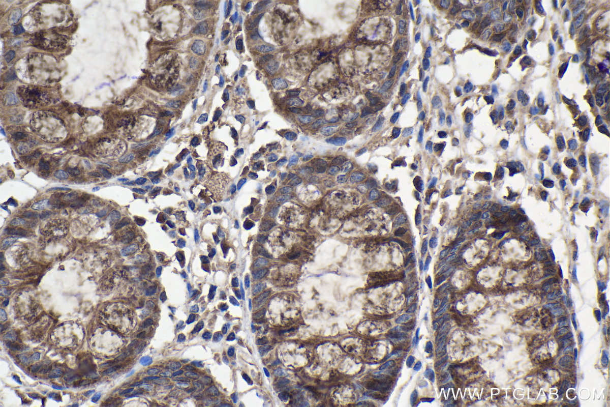 Immunohistochemistry (IHC) staining of human colon tissue using ABHD5 Polyclonal antibody (12201-1-AP)