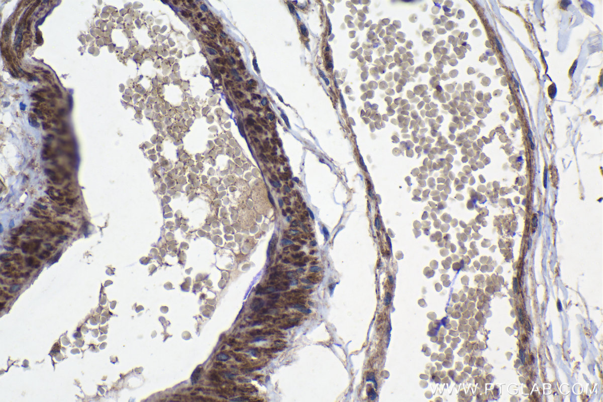 Immunohistochemistry (IHC) staining of human colon tissue using ABHD5 Polyclonal antibody (12201-1-AP)