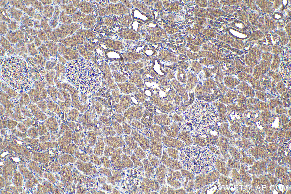 Immunohistochemistry (IHC) staining of human kidney tissue using ABHD5 Polyclonal antibody (12201-1-AP)