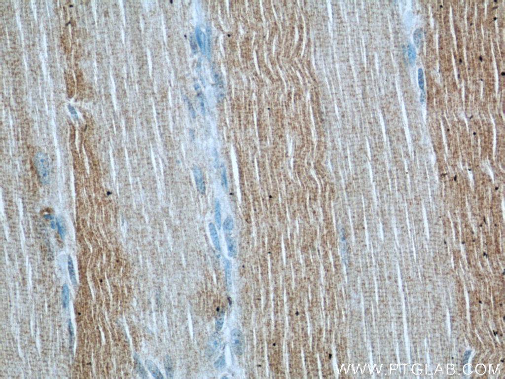 Immunohistochemistry (IHC) staining of human skeletal muscle tissue using ABHD5 Polyclonal antibody (12201-1-AP)