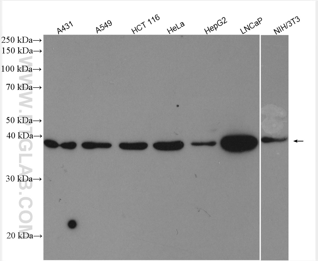 Western Blot (WB) analysis of various lysates using ABHD5 Polyclonal antibody (12201-1-AP)