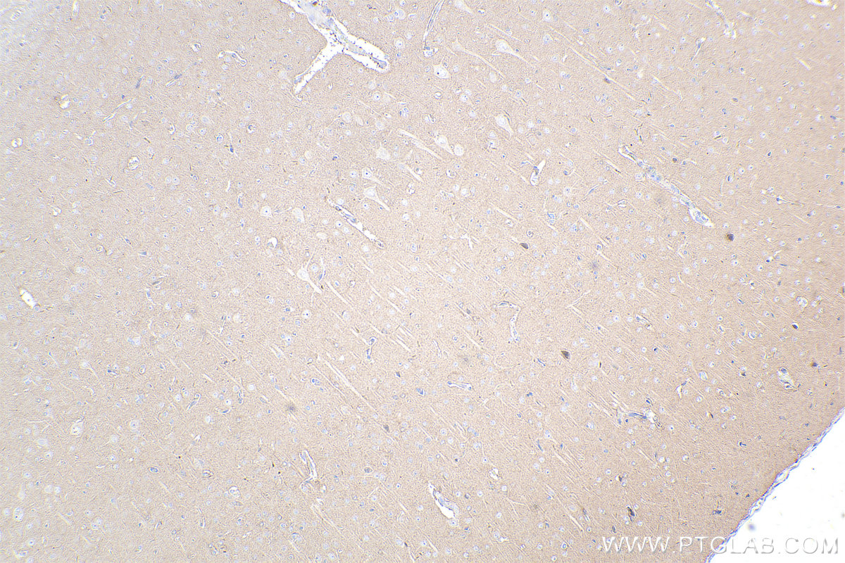 Immunohistochemistry (IHC) staining of rat brain tissue using ABR Polyclonal antibody (29350-1-AP)