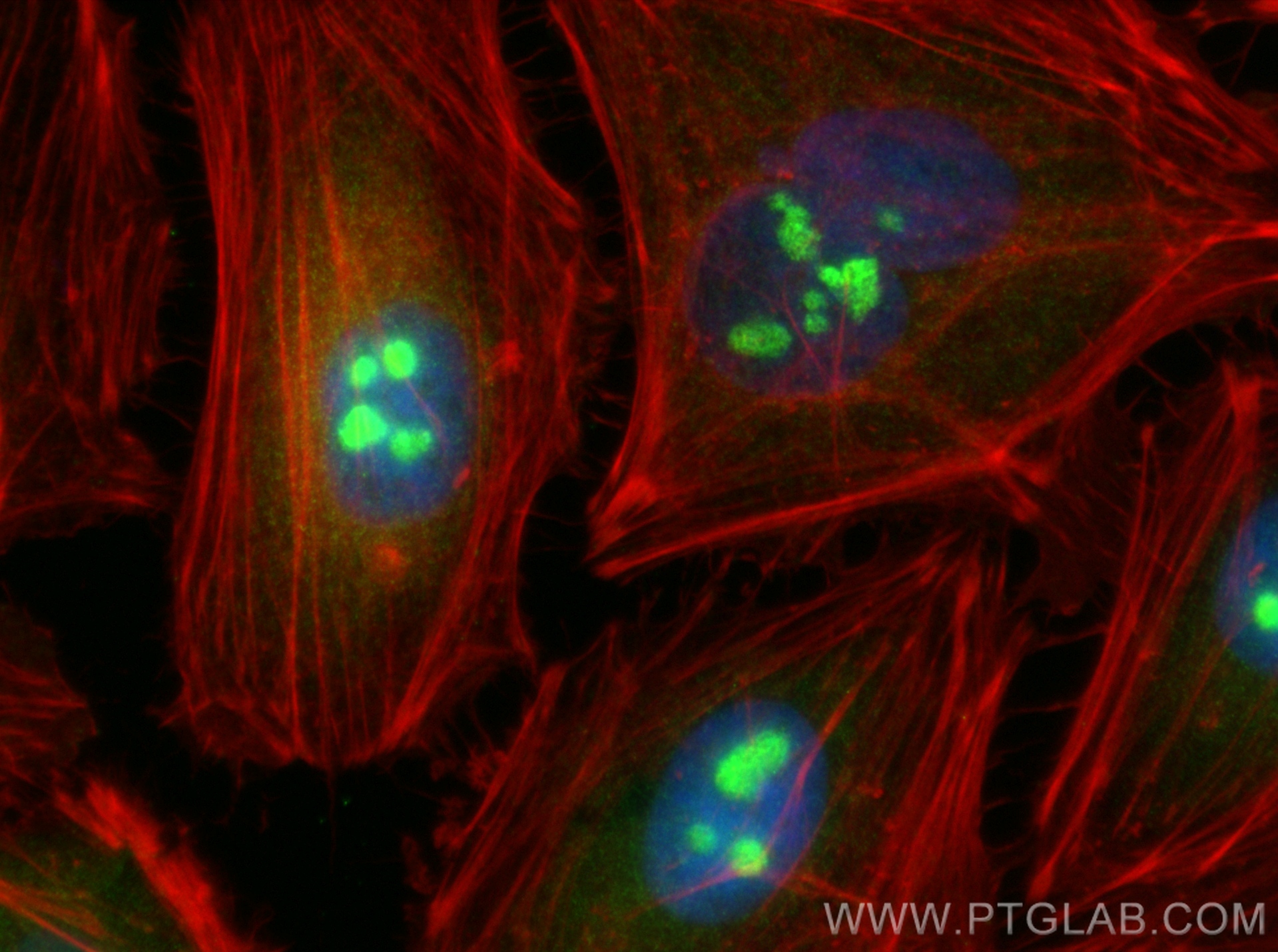 Immunofluorescence (IF) / fluorescent staining of HeLa cells using ABT1 Polyclonal antibody (14148-1-AP)