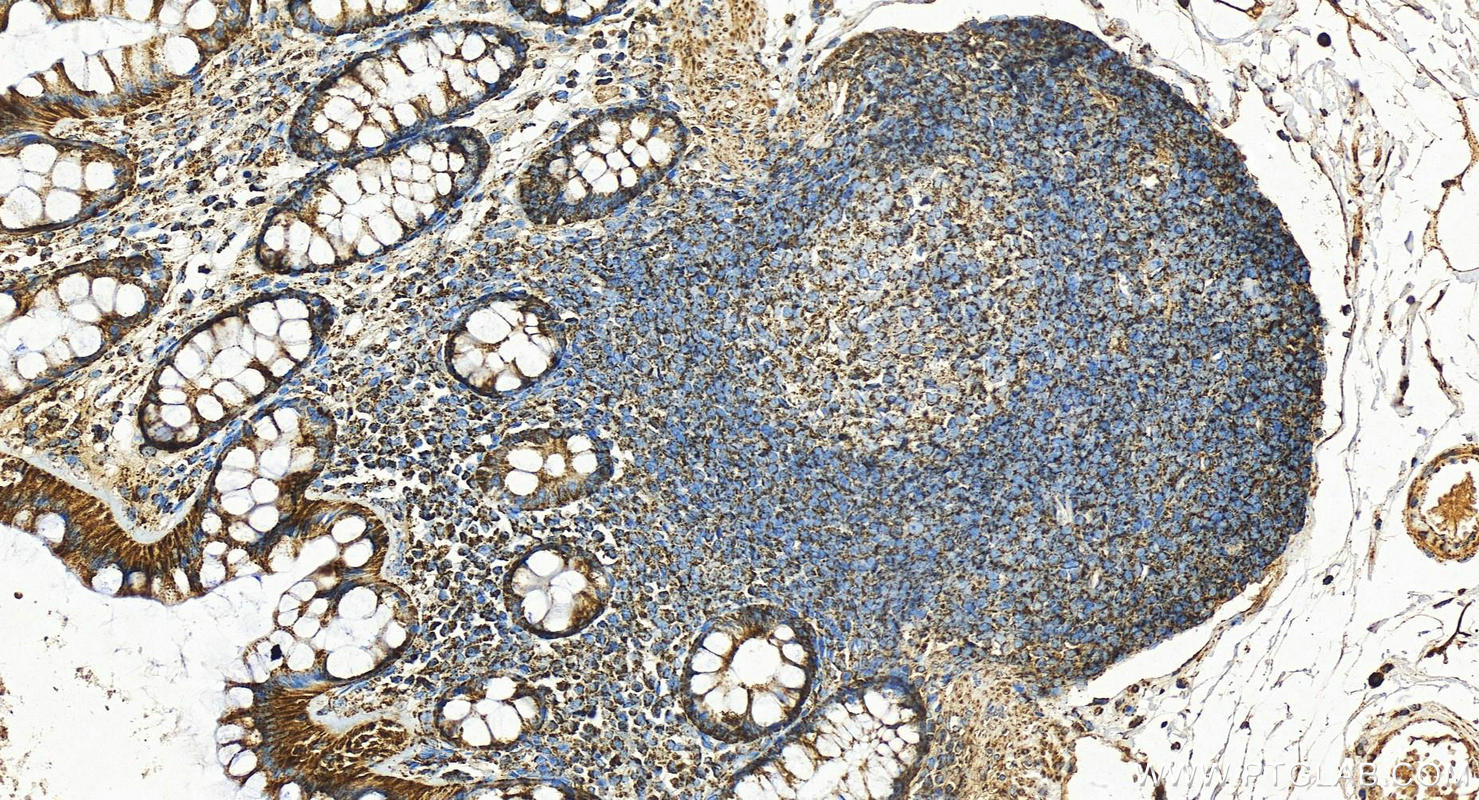 Immunohistochemistry (IHC) staining of human colon tissue using ACAA2 Polyclonal antibody (11111-1-AP)