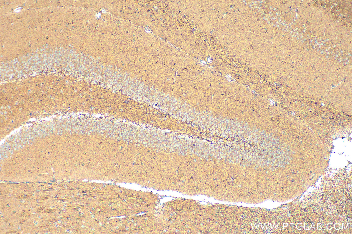 Immunohistochemistry (IHC) staining of mouse brain tissue using ACC1 Polyclonal antibody (21923-1-AP)