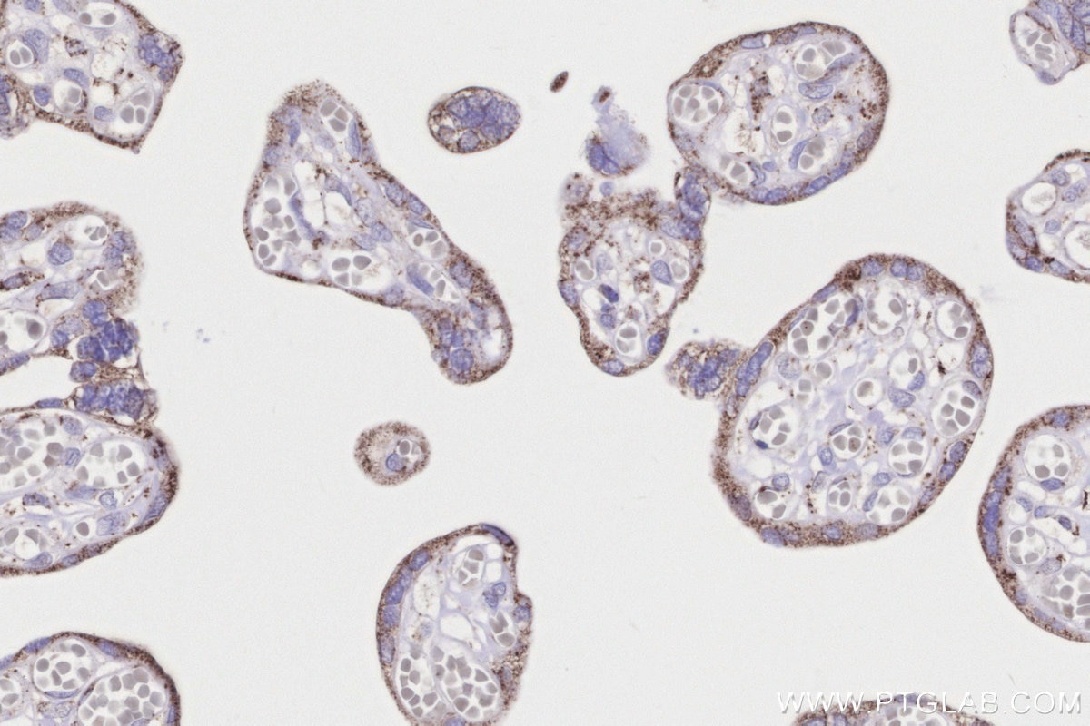 Immunohistochemistry (IHC) staining of human placenta tissue using ACADS Polyclonal antibody (16623-1-AP)