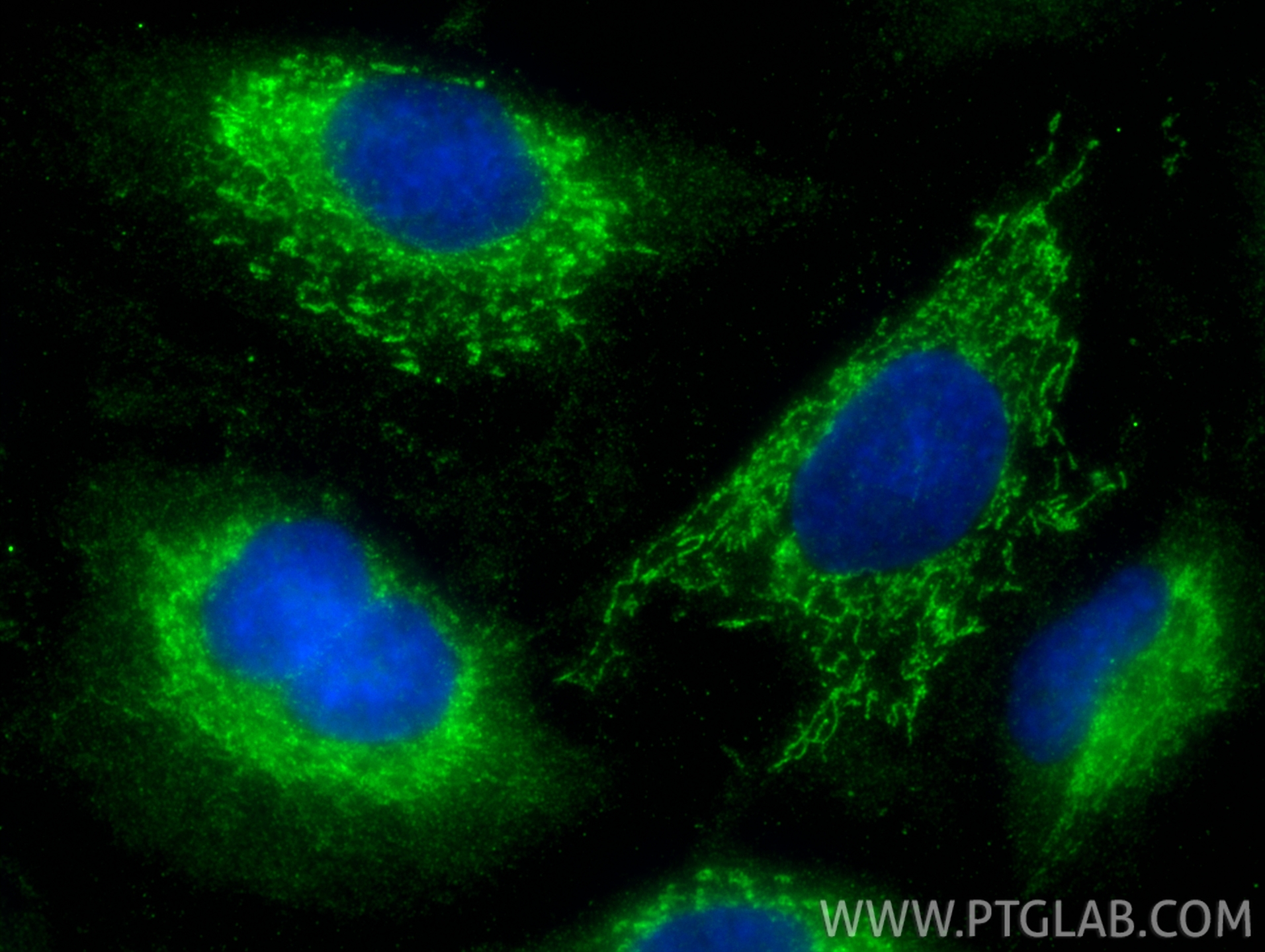 Immunofluorescence (IF) / fluorescent staining of A549 cells using ACADVL Polyclonal antibody (14527-1-AP)
