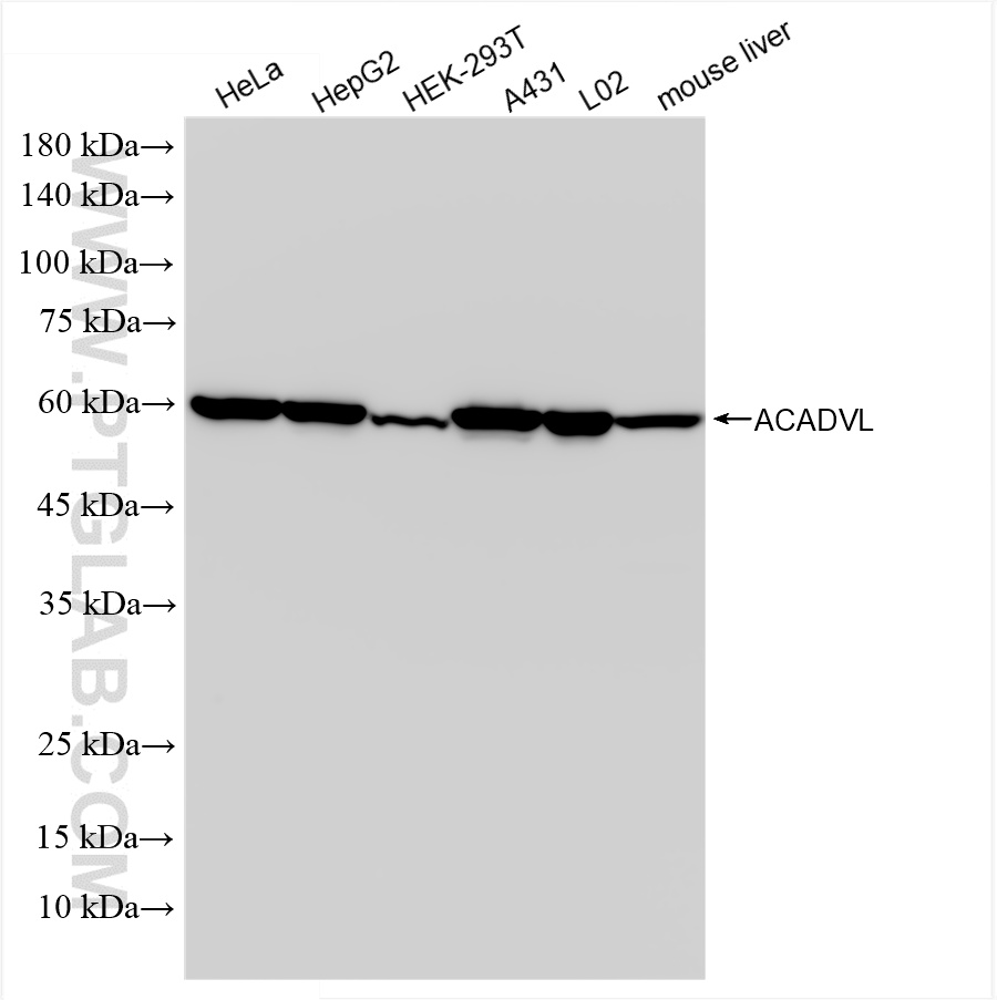Western Blot (WB) analysis of various lysates using ACADVL Recombinant antibody (85889-1-RR)