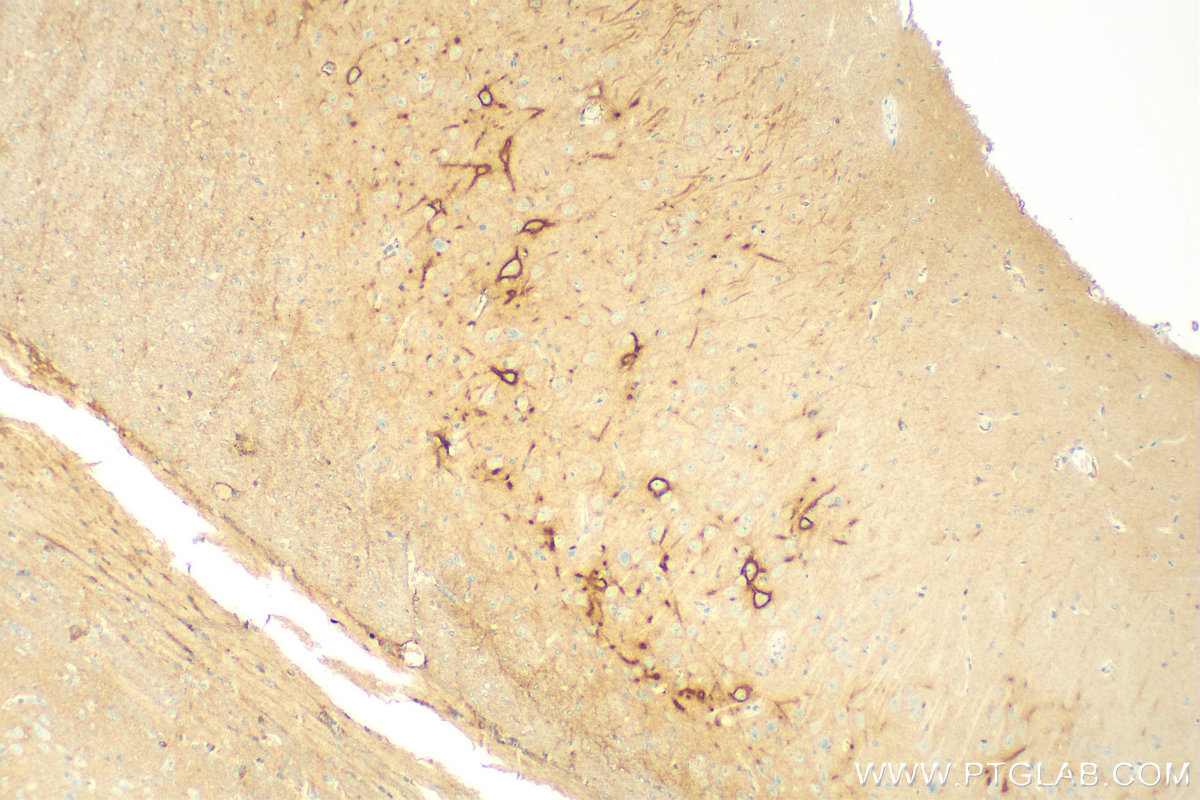 Immunohistochemistry (IHC) staining of rat brain tissue using Aggrecan Polyclonal antibody (13880-1-AP)