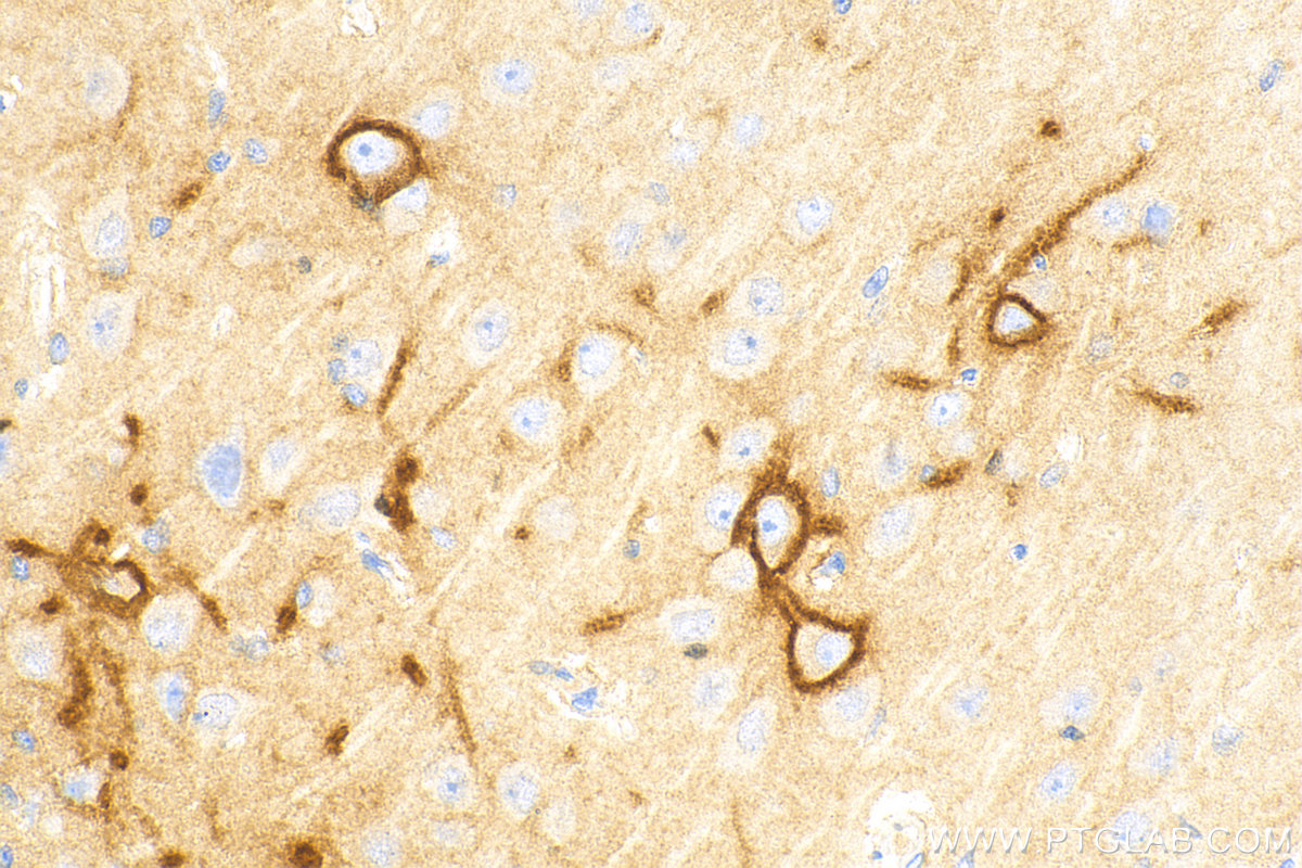 Immunohistochemistry (IHC) staining of rat brain tissue using Aggrecan Polyclonal antibody (13880-1-AP)