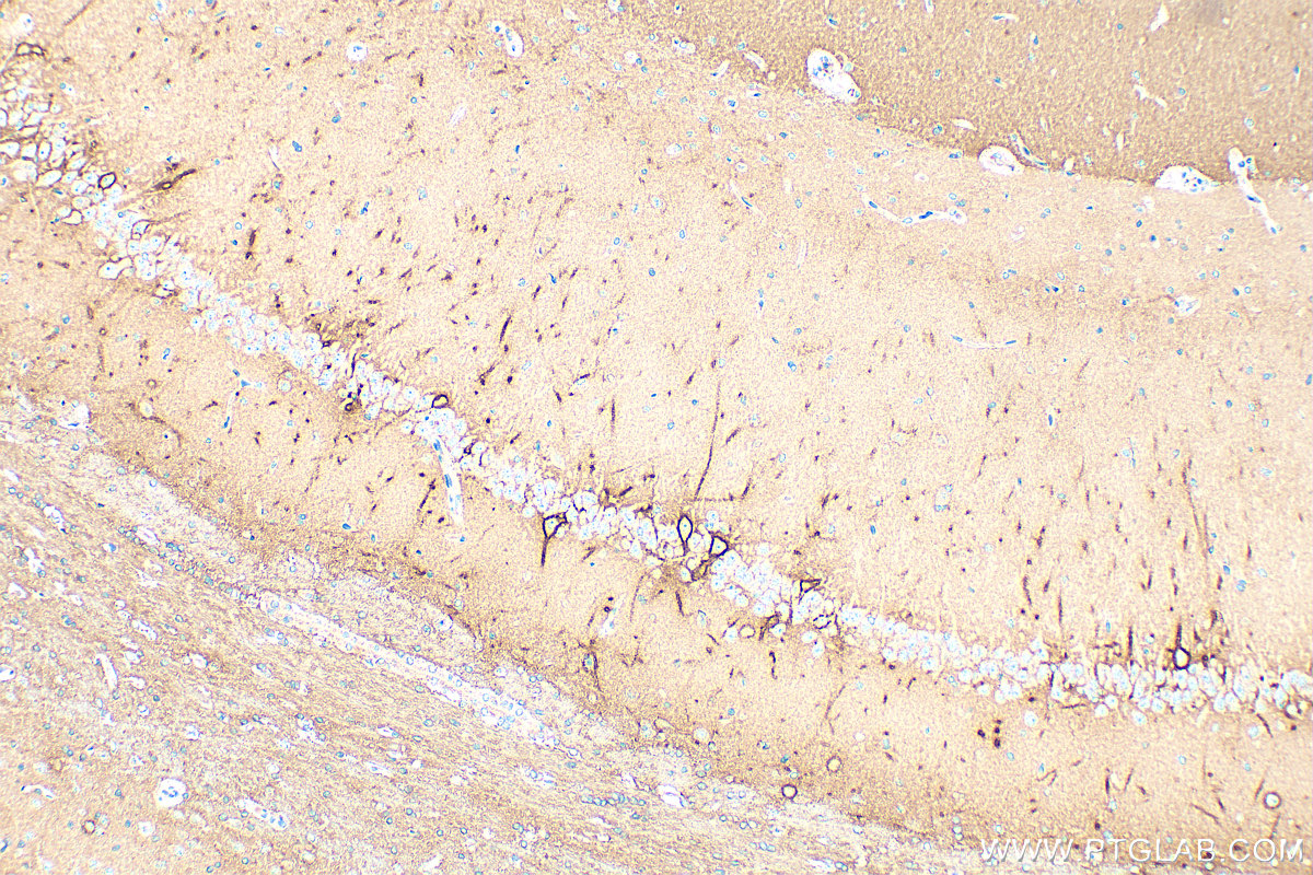 Immunohistochemistry (IHC) staining of rat brain tissue using Aggrecan Polyclonal antibody (13880-1-AP)