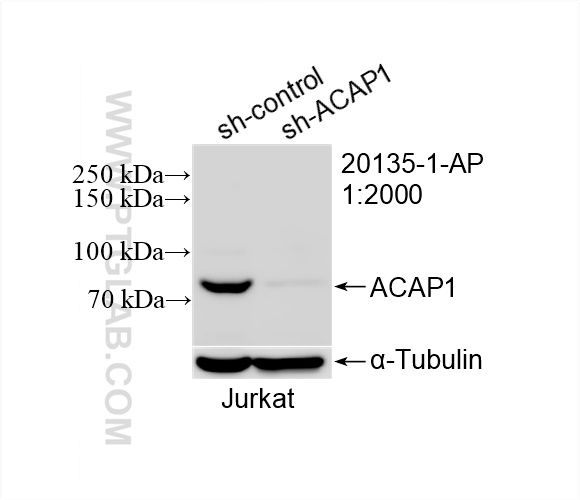 Western Blot (WB) analysis of Jurkat cells using ACAP1 Polyclonal antibody (20135-1-AP)