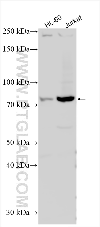 Western Blot (WB) analysis of various lysates using ACAP1 Polyclonal antibody (20135-1-AP)