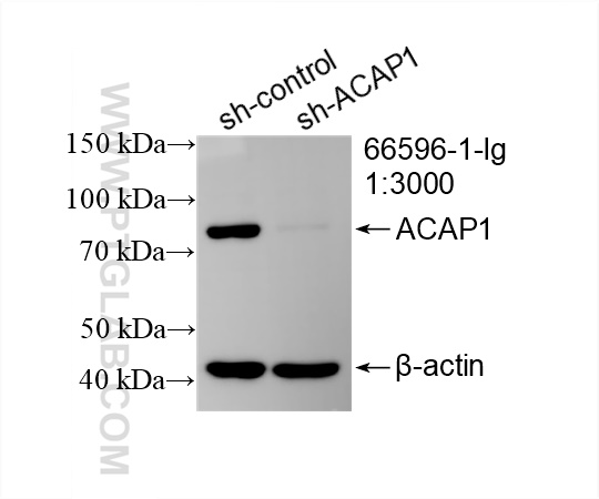 Western Blot (WB) analysis of Jurkat cells using ACAP1 Monoclonal antibody (66596-1-Ig)