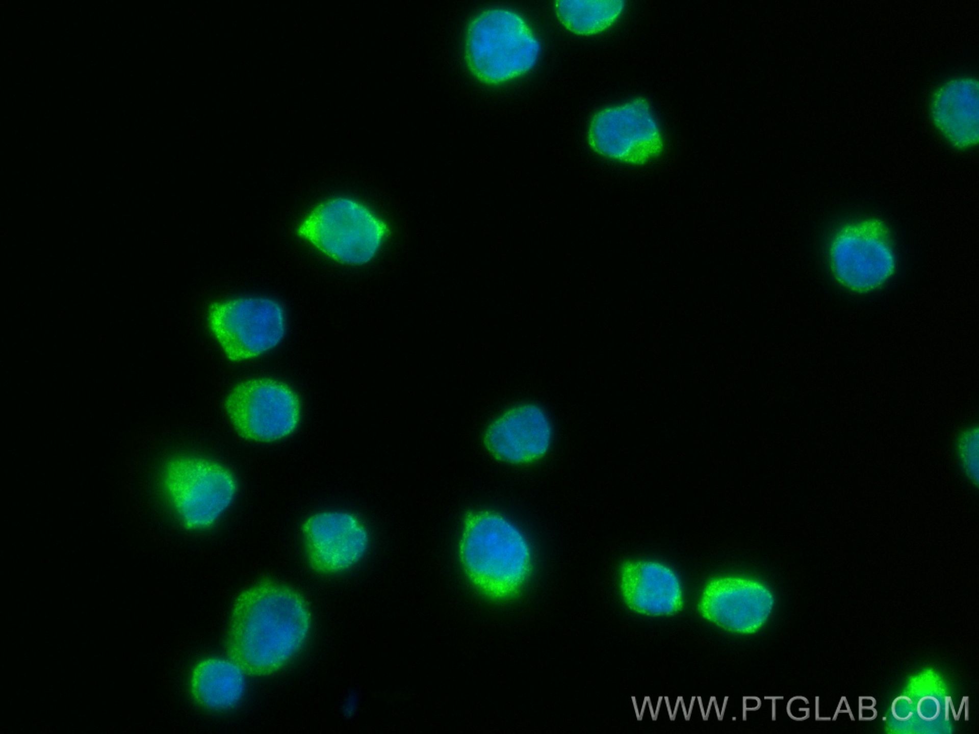 Immunofluorescence (IF) / fluorescent staining of Jurkat cells using ACAP1 Recombinant antibody (82967-1-RR)