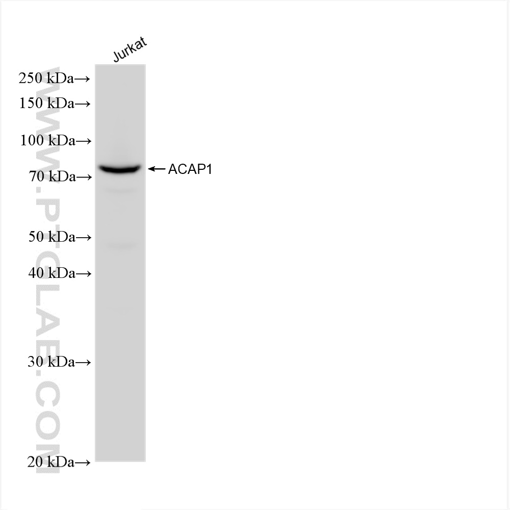 Western Blot (WB) analysis of Jurkat cells using ACAP1 Recombinant antibody (82967-1-RR)
